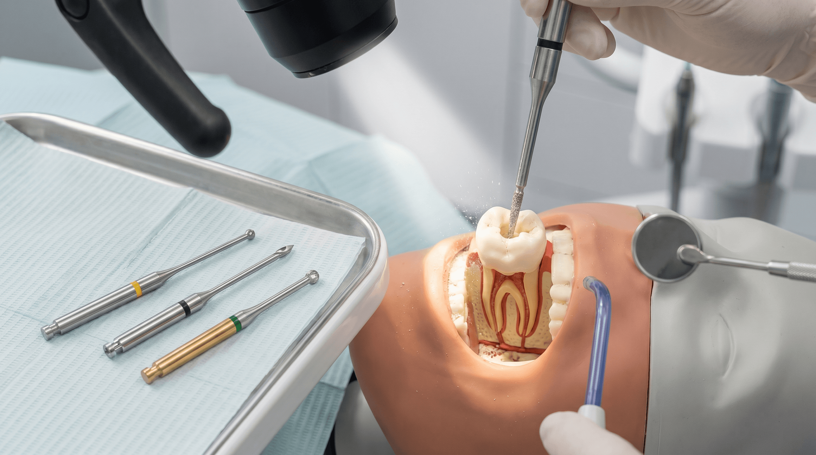 Endodontics: creating access and preparing the canal