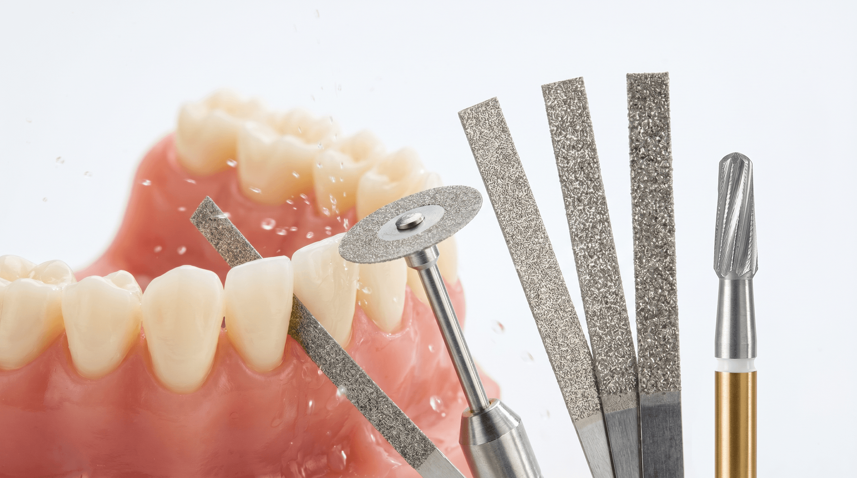 IPR: safely removing interproximal enamel and adhesive residue