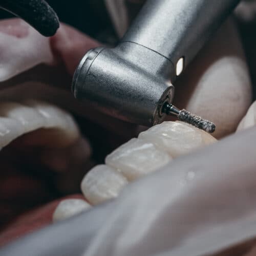 Diamond instruments
