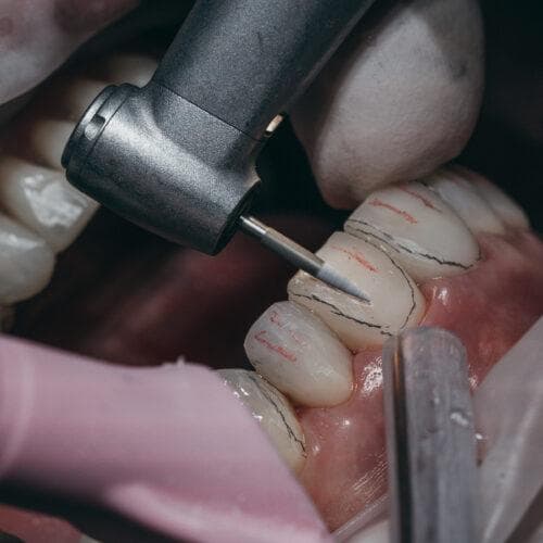 Carbide instruments